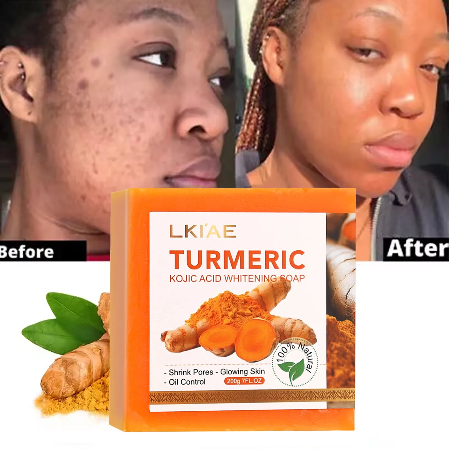 Natural Turmeric Whitening Soap For Spots