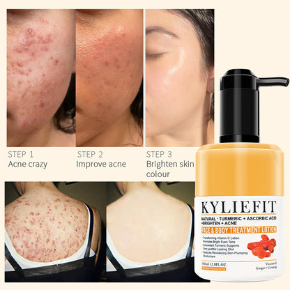 Natural Turmeric Whitening Lotion For Spots