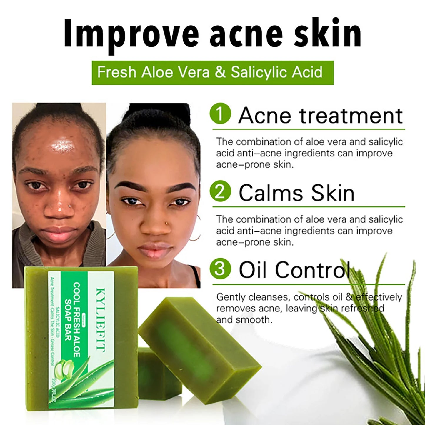 Cool Fresh Aloe Soap For Acne