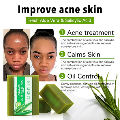 Cool Fresh Aloe Soap For Acne