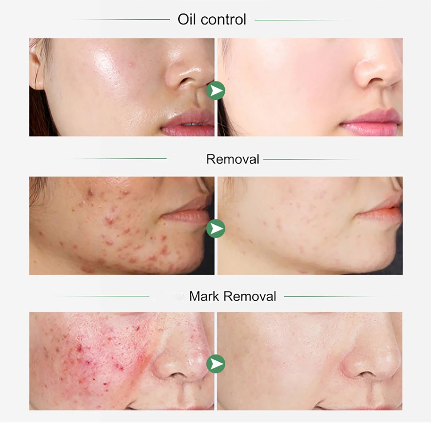 Organic Turmeric Vitamin C Whitening Set