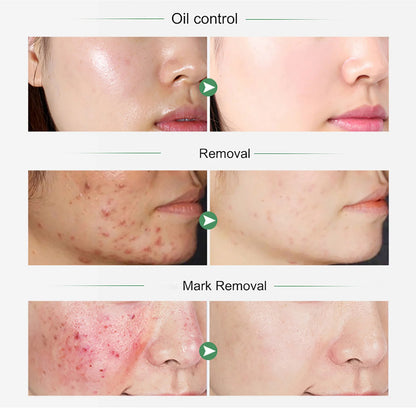 Organic Turmeric Vitamin C Whitening Set