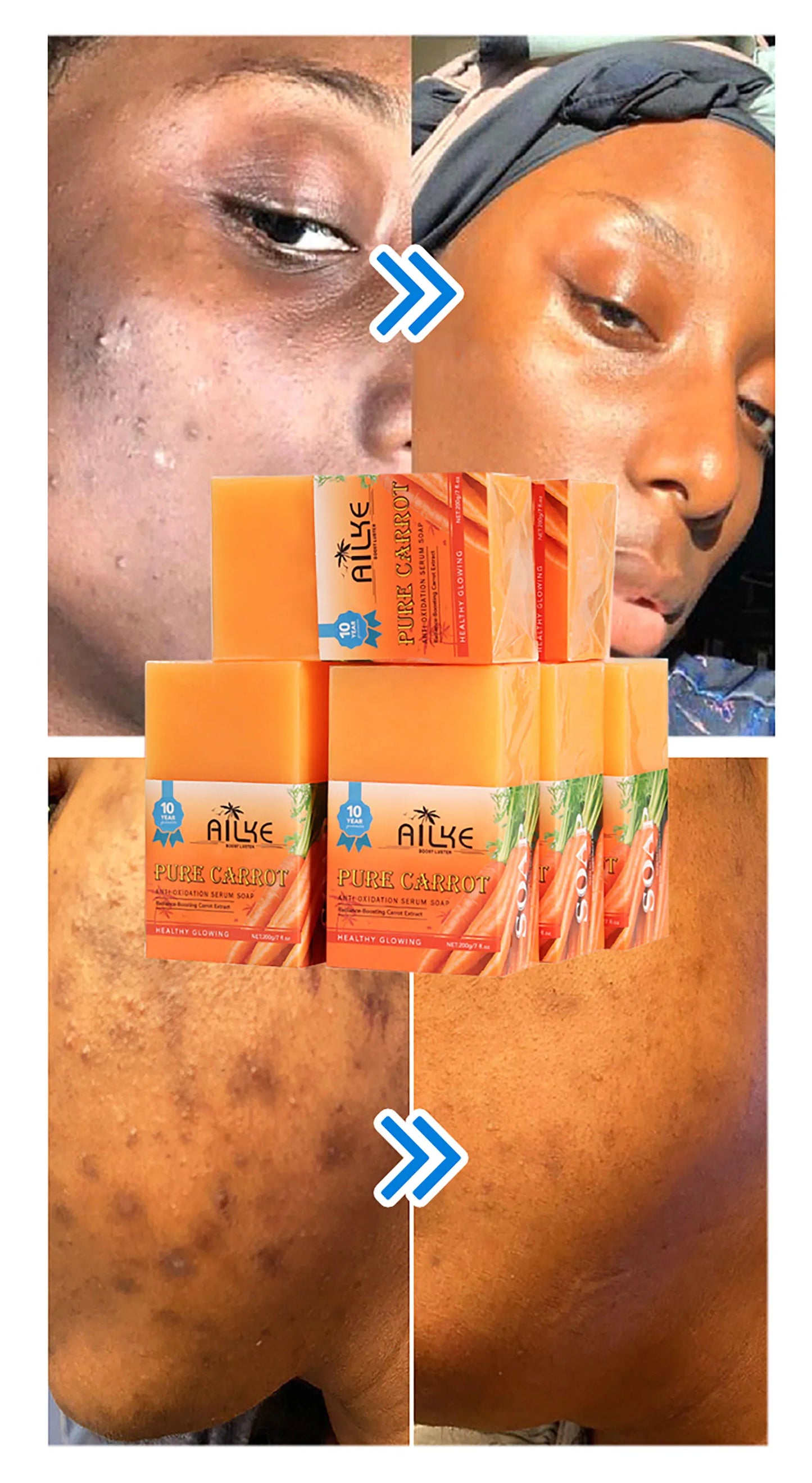 Carrot Vitamin C Whitening Soap