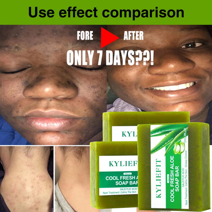Cool Fresh Aloe Soap For Acne