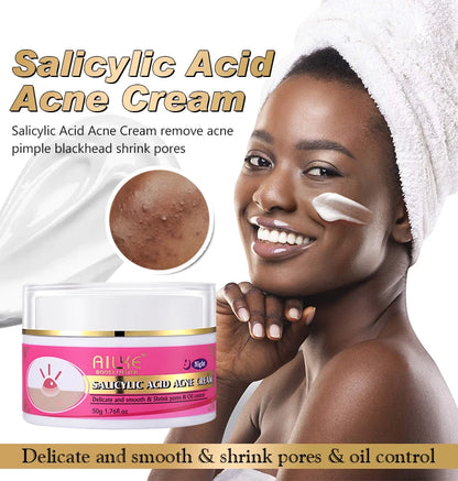 Acne Removal Face Cream For Clear Skin