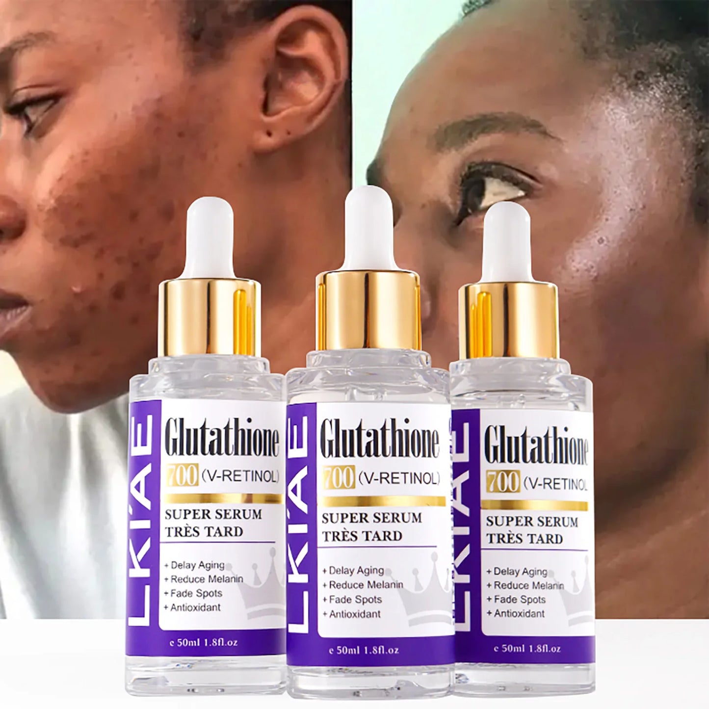 Glutathione Retinol Whitening Essence For Spots