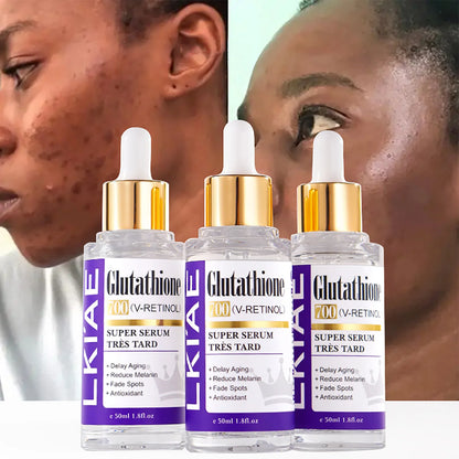 Glutathione Retinol Whitening Essence For Spots