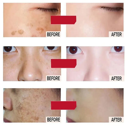 Whitening Anti-Wrinkle Carotene Facial Cream