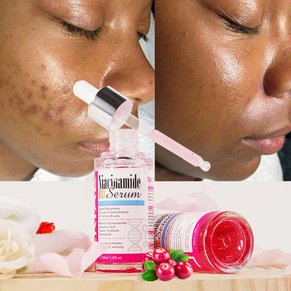 Nicotinamide Whitening Essence Serum