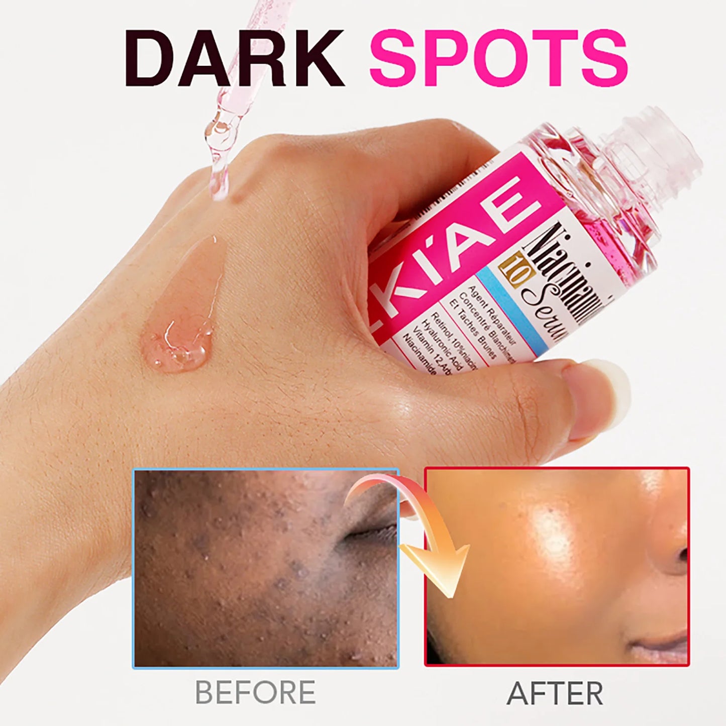 Nicotinamide Whitening Essence Serum